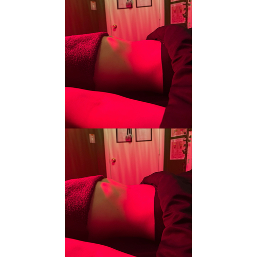 #1 BEFORE Lymphatic Drainage. at RELAXING BRANDY Therapeutic Massage in Taylor, MI