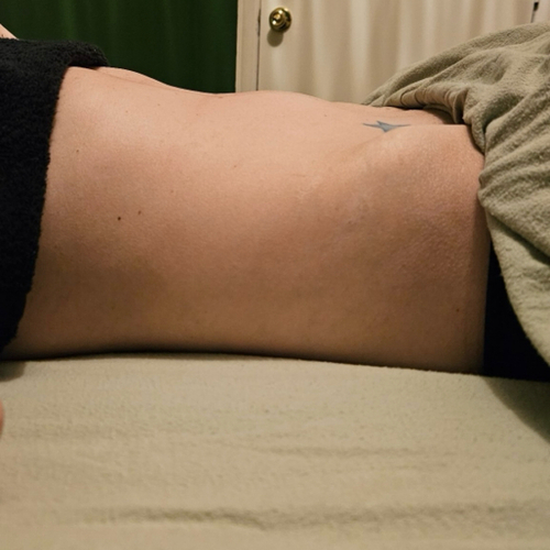 #2 AFTER Lymphatic Drainage. at RELAXING BRANDY Therapeutic Massage in Taylor, MI