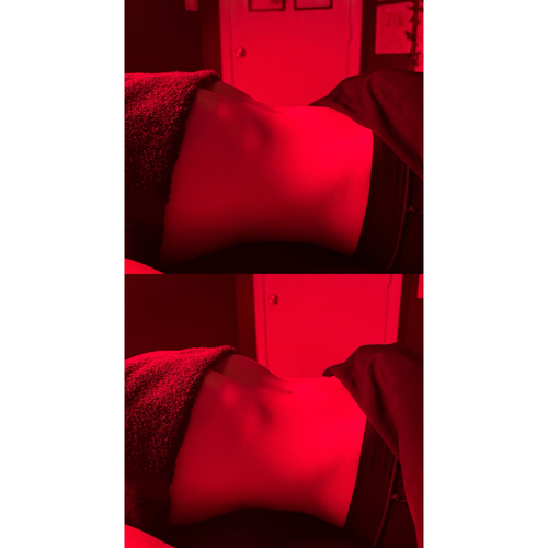 #2 AFTER Lymphatic Drainage. at RELAXING BRANDY Therapeutic Massage in Taylor, MI